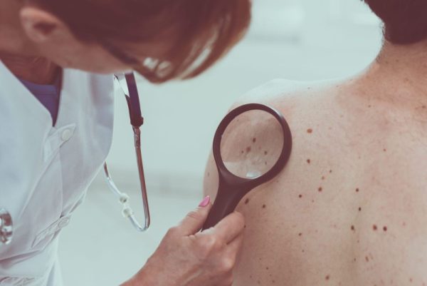 understanding-the-dangers-of-skin-cancer:-how-personal-trainers-can-advise-clients